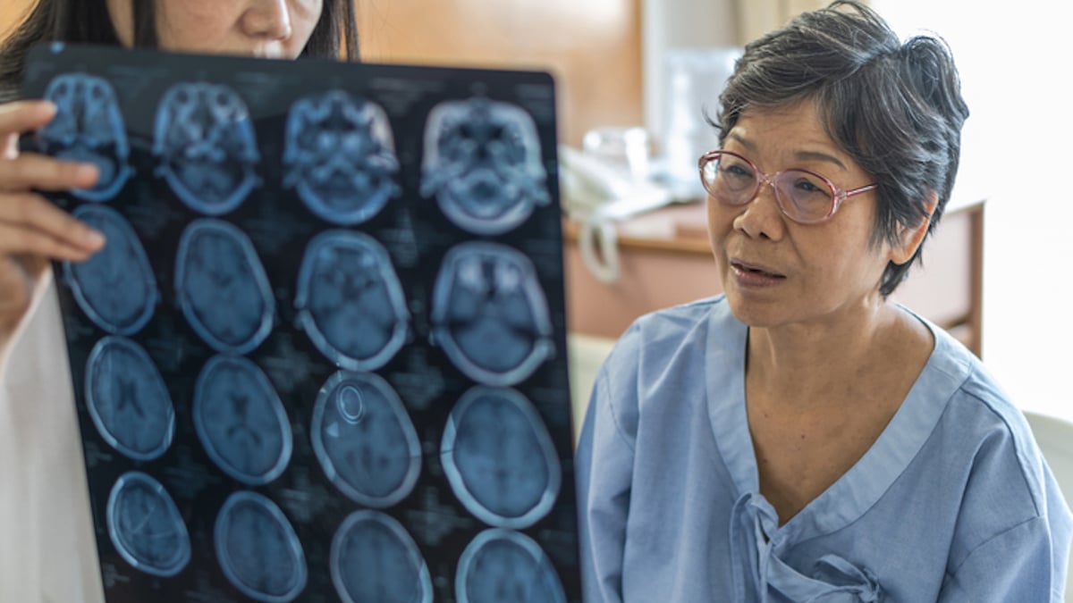 Ces 2 questions anodines peuvent révéler des signes d'Alzheimer, selon un neurologue