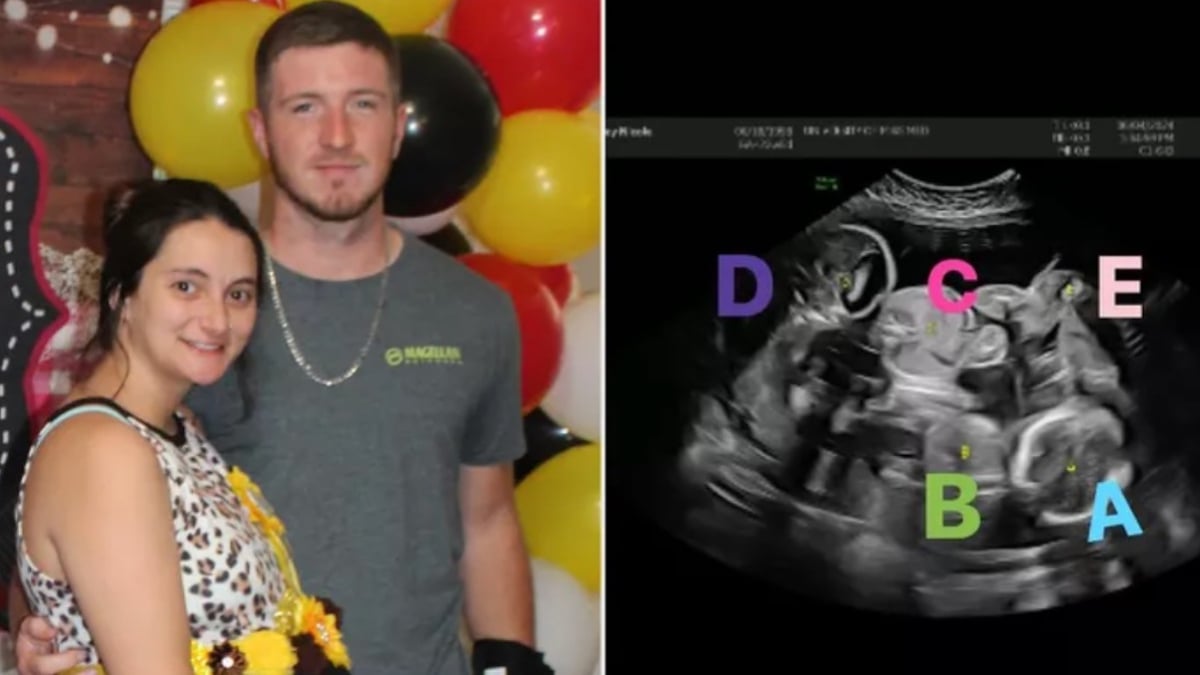 Ashley Meyers et son époux pendant la baby shower / photo de l'échographie 