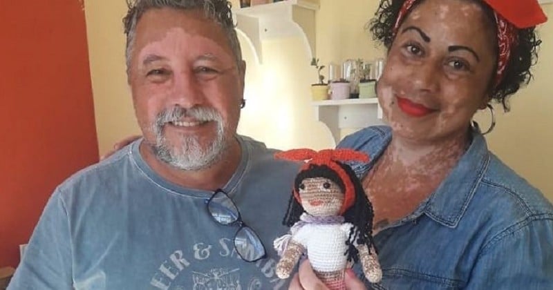Cet homme crée de jolies poupées vitiligo pour décomplexer les enfants atteints par cette maladie