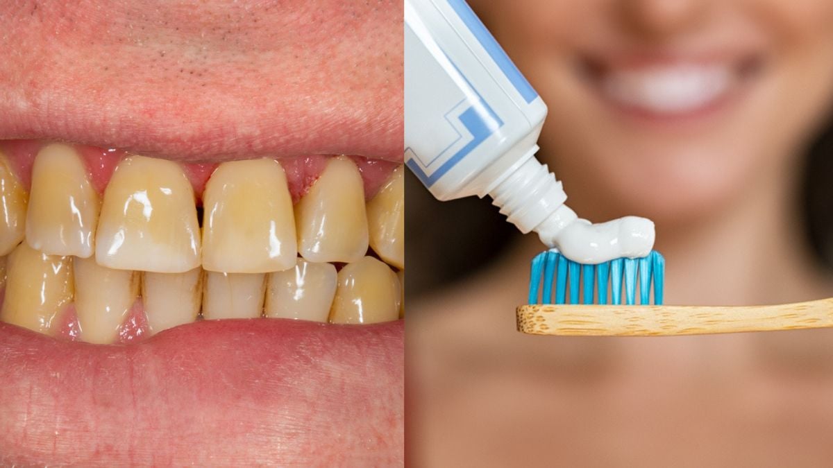 Voici les vraies raisons pour lesquelles vous avez les dents jaunes, selon des dentistes