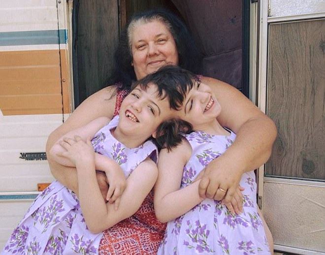 Krista et Tatiana Hogan, deux soeurs jumelles siamoises avec leur mère Felicia