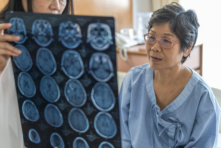 Une femme atteinte de troubles cognitifs