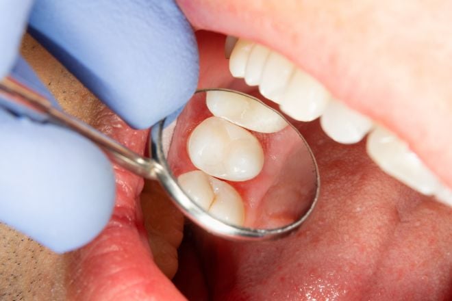 Dentition lors d'un rendez-vous chez le dentiste