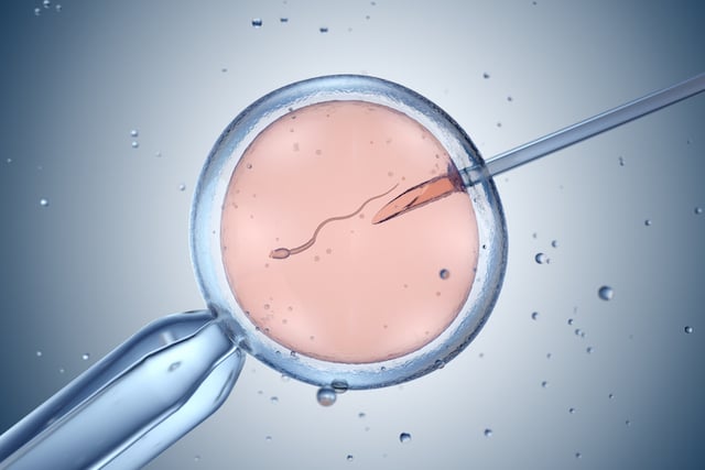 Illustration montrant une fécondation in vitro